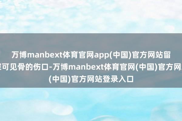 万博manbext体育官网app(中国)官方网站留住一说念深可见骨的伤口-万博manbext体育官网(中国)官方网站登录入口